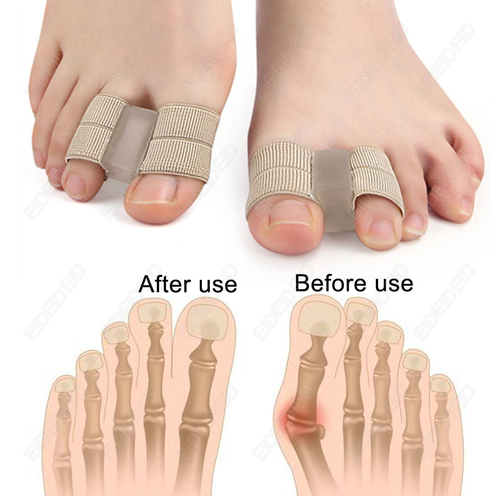 Bunion toe Corrector Orthotics - Women'S Shoes With Bunions incelemesi ve fiyatı
